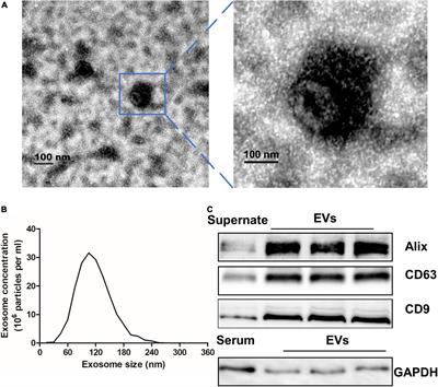 Circulating exo-miR-154-5p regulates vascular dementia through endothelial progenitor cell-mediated angiogenesis